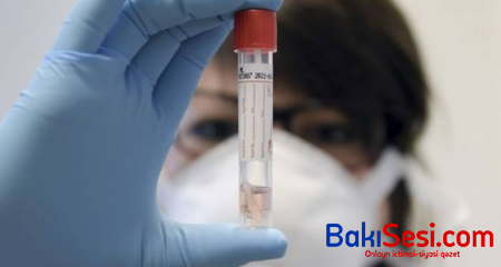 Azərbaycanda ümumilikdə 820 002 koronavirus testi aparılıb
