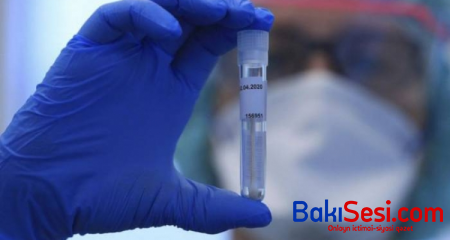 Rusiyada koronavirusa qarşı peyvəndin istehsalına başlanılıb