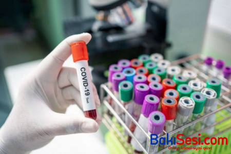 Ölkədə aparılan testlərin sayı 843 mini keçdi