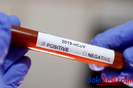 161 koronavirus xəstəsi reanimasiyadadır - RƏSMİ