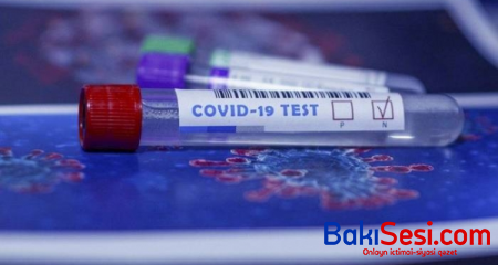 Azərbaycanda ümumilikdə 928 666 koronavirus testi aparılıb