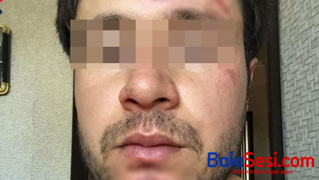 “Pul vermədim deyə baş həkim məni yumruqladı” - FOTO