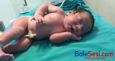 Bakıda yeni doğulan körpənin oğurlanması iddiası barədə rəsmi açıqlama