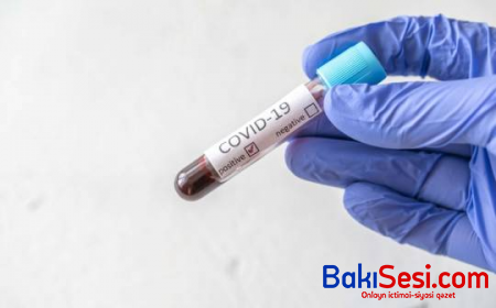 Azərbaycanda daha 139 yoluxma qeydə alınıb, 1 nəfər ölüb