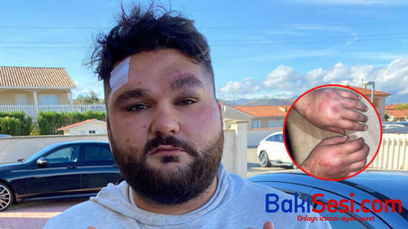 “Fransa polisi müdaxilə etmədi, tibbi yardım da vaxtında gəlmədi” - Ermənilərin hücum etdiyi türklər - FOTOLAR