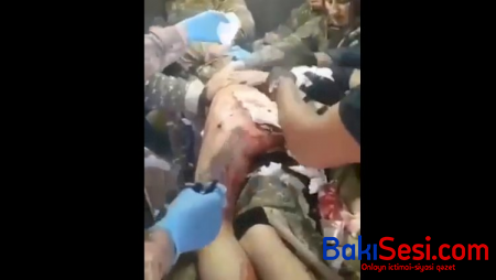 Araik Arutyunyanın hospitaldan görüntüləri yayıldı - Video