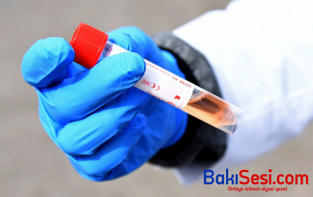 Azərbaycanda koronavirus sayında yeni rekord - Günün statistikası