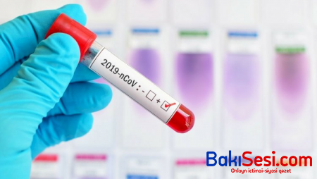 Koronavirusa yoluxma qorxusu əhalinin psixi sağlamlığında…