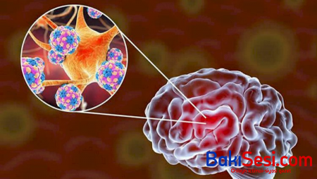 Koronavirus uzun müddət beyin və bağırsaqlarda qalır - Alimlər
