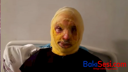 Bərdədə qız görüşdüyü oğlanı niyə yandırıb? – Oğlanın anası danışdı + VİDEO