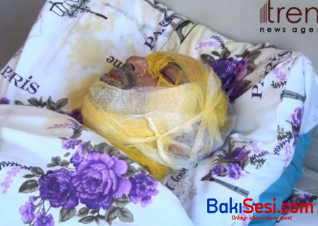 Bərdədə qız sevgilisini niyə yandırdı? - TƏFƏRRÜATLAR