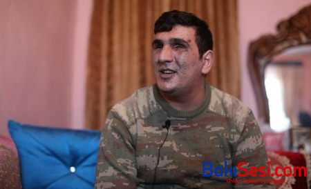 Vətən müharibəsində iki gözünü itirən qazimiz: “Mənə kömək göstərilsin, ailəmin üzünə baxa bilim”