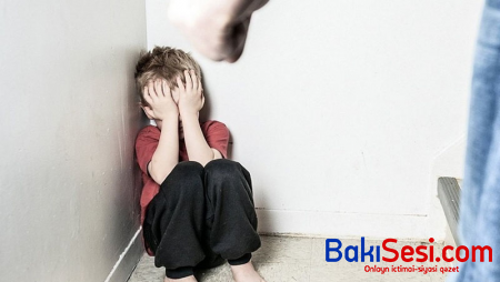 Kişi və arvadı uşaqları qızdırılmış bıçaqla yandırdı - Bakıda vəhşilik
