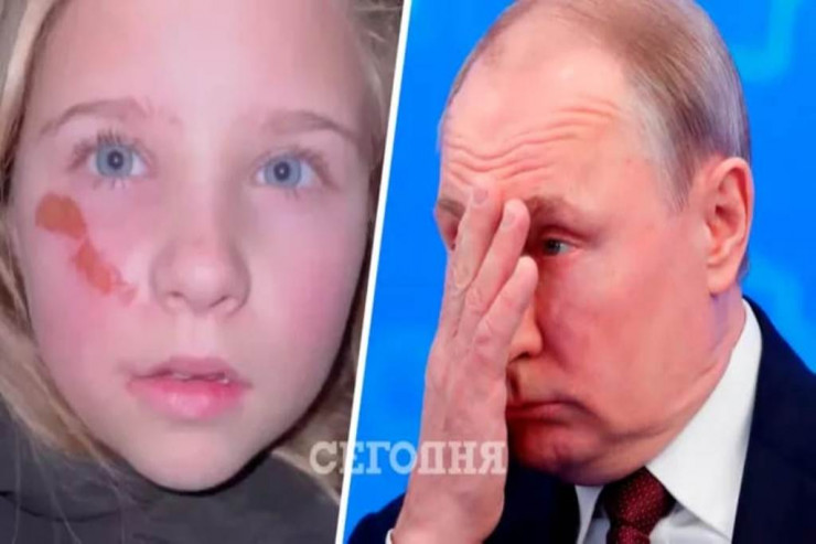 Ukrayna uşaqlarından Putinə MÜRACİƏT -VİDEO