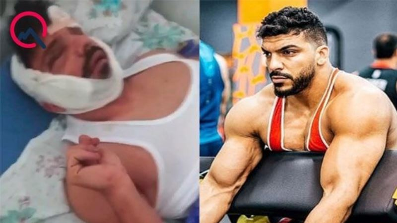 Partlayışda ağır yaralanan çempionun son halı - FOTO