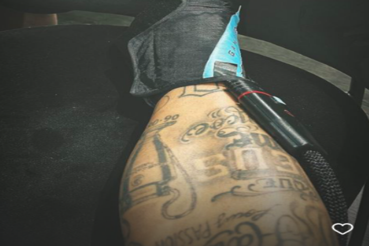 Neymar zədəli ayağının fotosunu yaydı