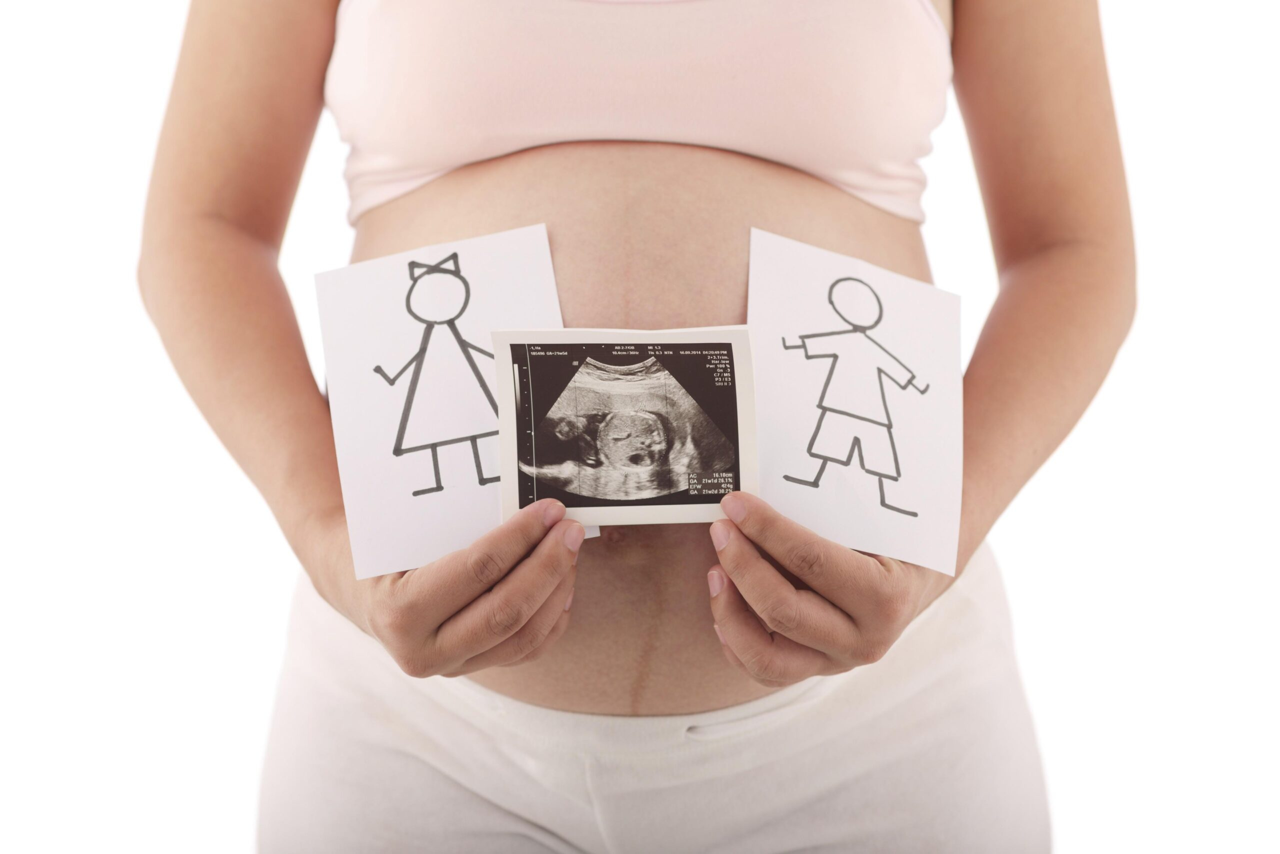 Dünyada selektiv abortlara görə Azərbaycan artıq ilk sıralarda deyil