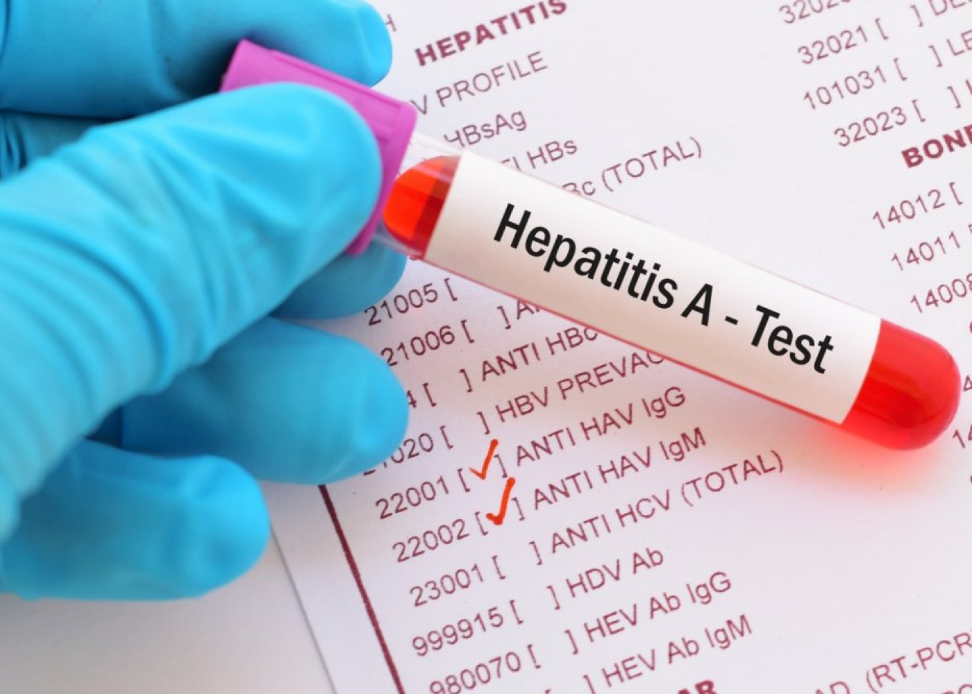 Hepatit A virusu Yevlaxda da AŞKARLANDI