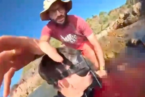 Köpəkbalığı dənizdə video çəkən gəncin ayağını qopardı